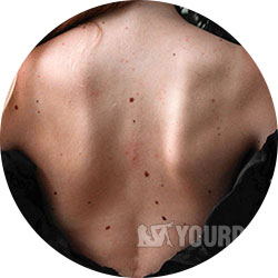Body Freckles